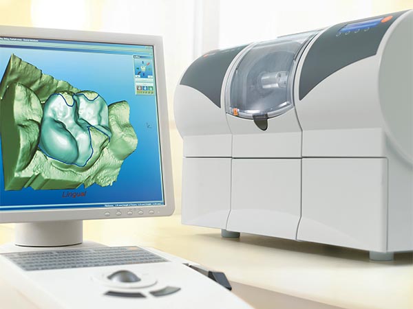 cerec digital dentistry