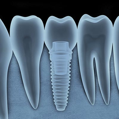 cone beam computed tomography x ray image illustration