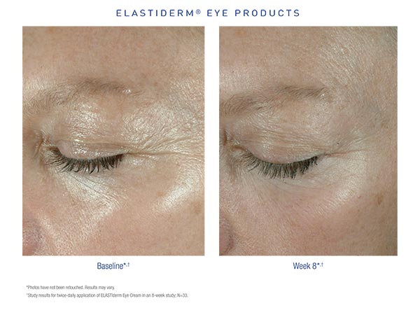 obagi skin care elastiderm